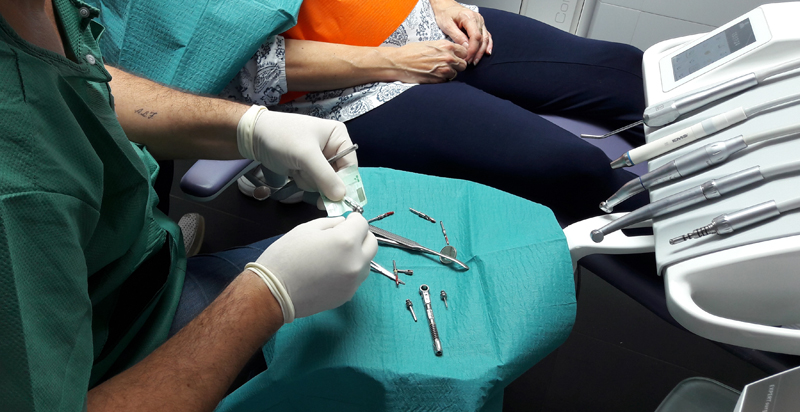 Preparation pour implant dentaire